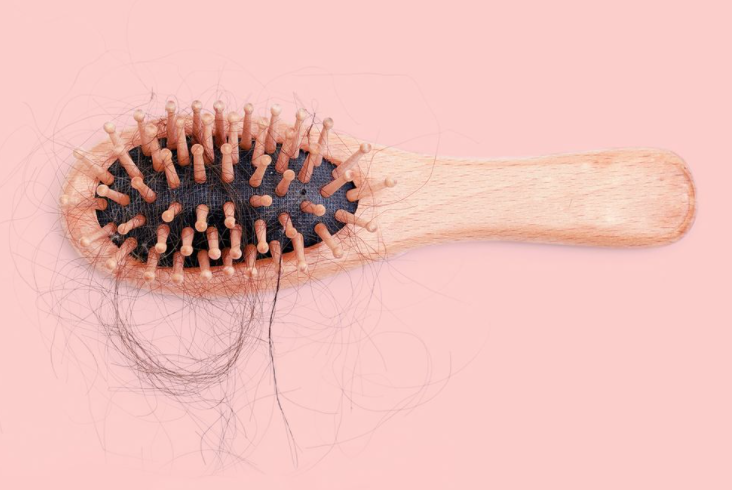 Temporary or Permanent? Our Post-Covid Impact Hair Loss 'Mystery' Verified